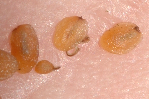 Plantaginaceae Hebe 