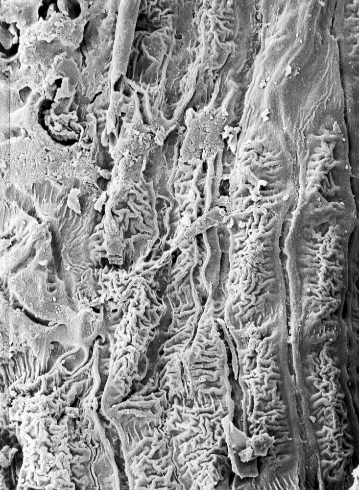 Hydrangeaceae Tylerianthus crossmanensis