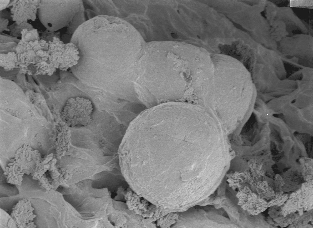 Nymphaeaceae Microvictoria svitkoana