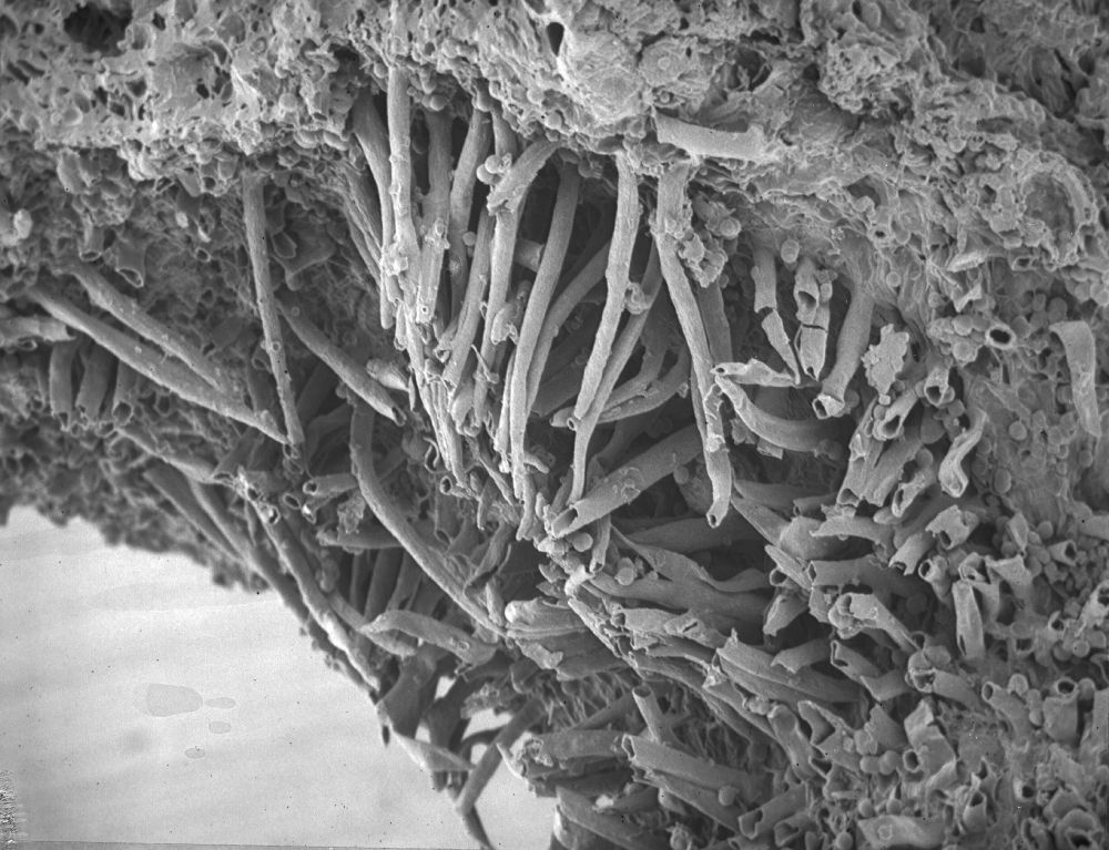 Clusiaceae Paleoclusia chevalieri