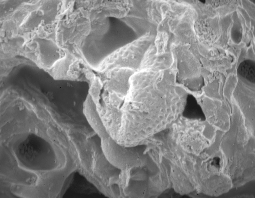 Clusiaceae Paleoclusia chevalieri