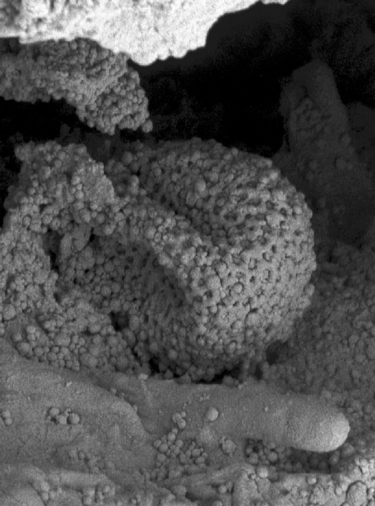 Clusiaceae Paleoclusia chevalieri