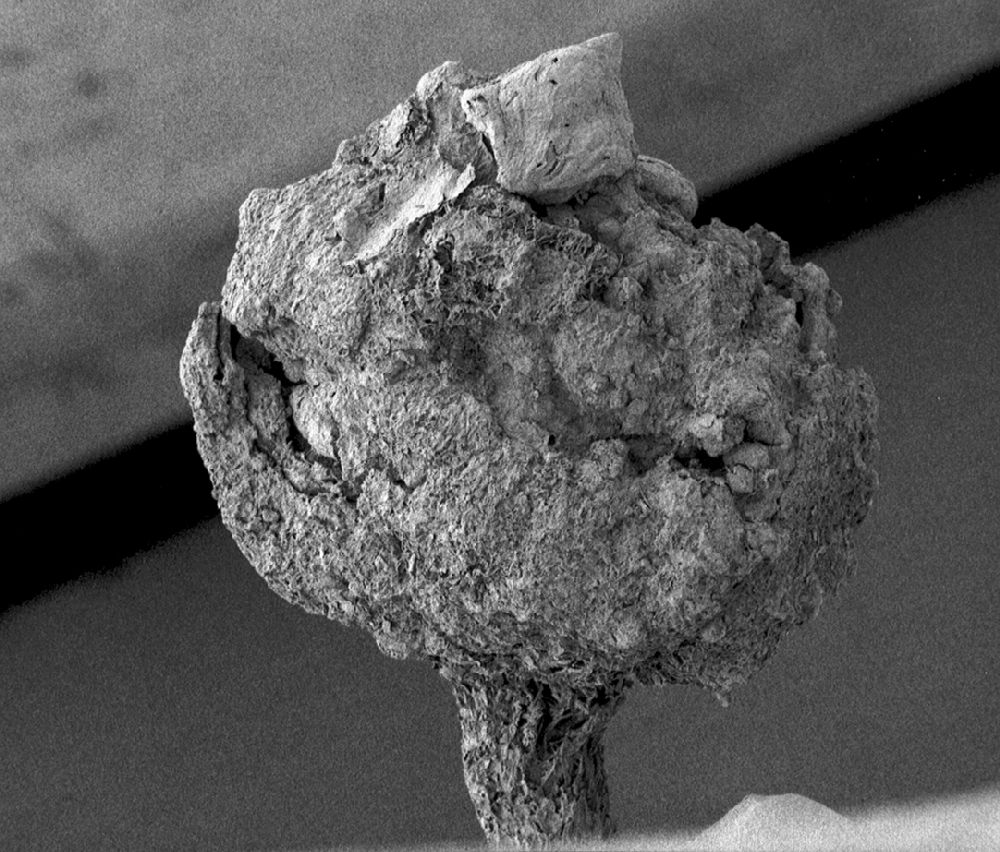 Clusiaceae Paleoclusia chevalieri