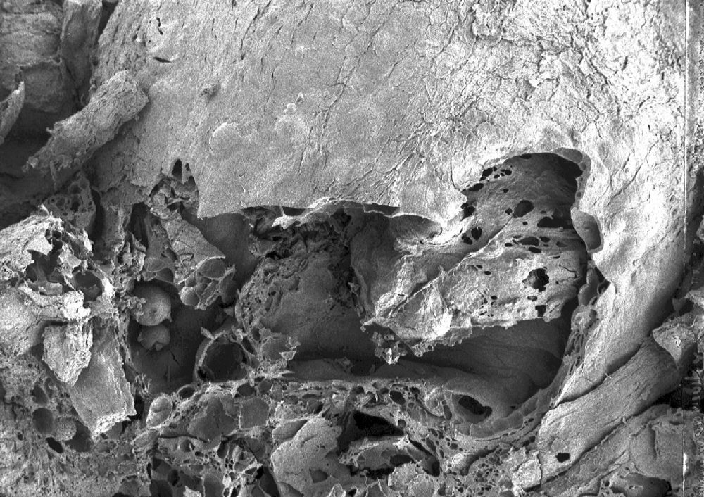 Clusiaceae Paleoclusia chevalieri