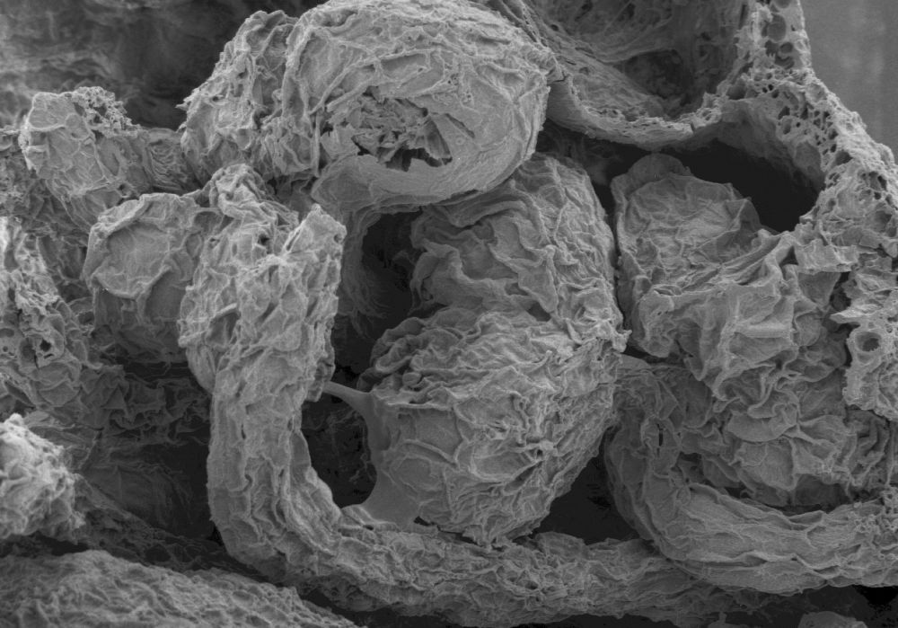 Clusiaceae Paleoclusia chevalieri