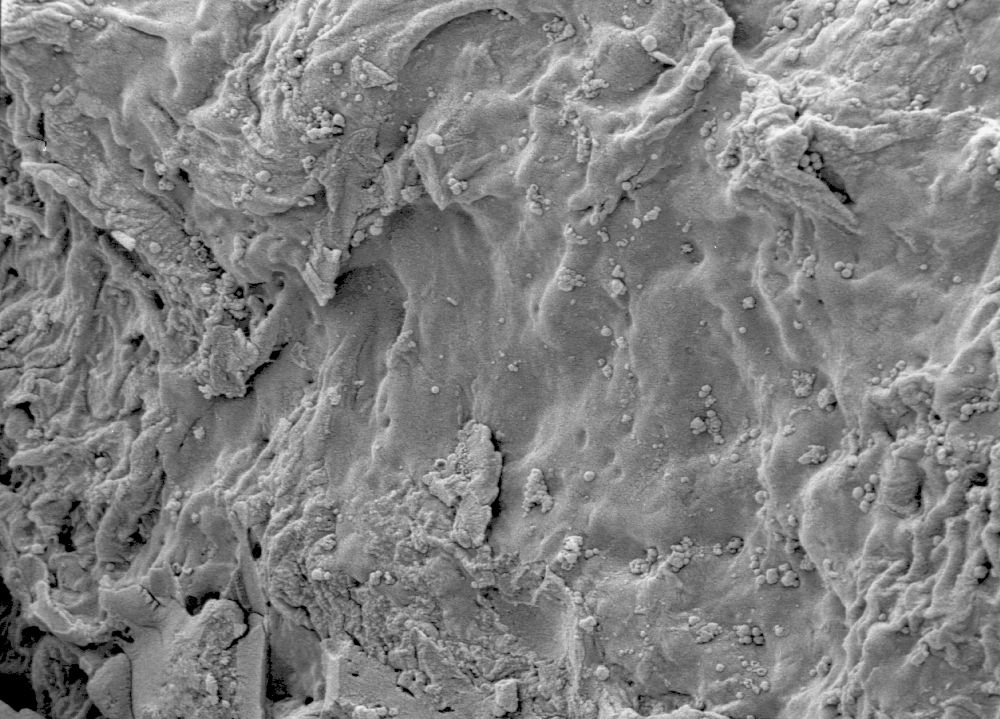 Clusiaceae Paleoclusia chevalieri