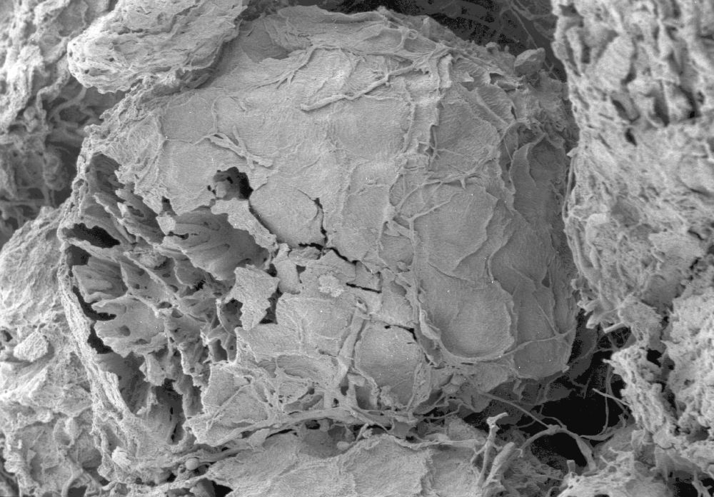 Clusiaceae Paleoclusia chevalieri