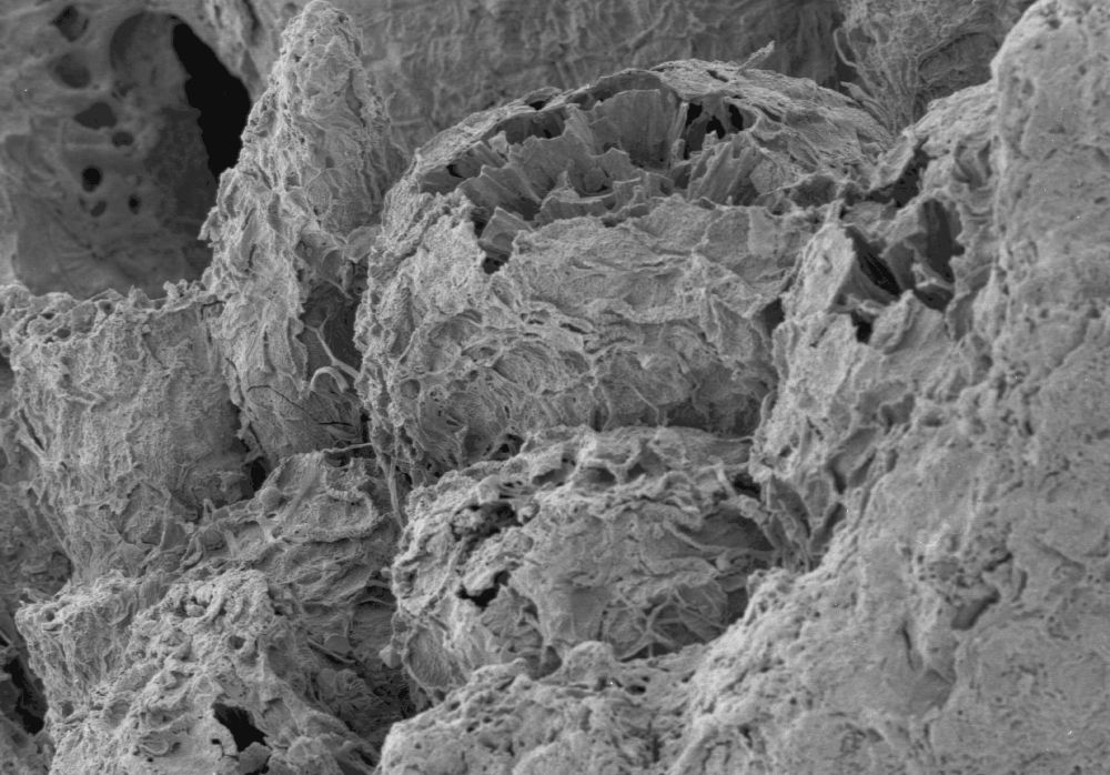 Clusiaceae Paleoclusia chevalieri