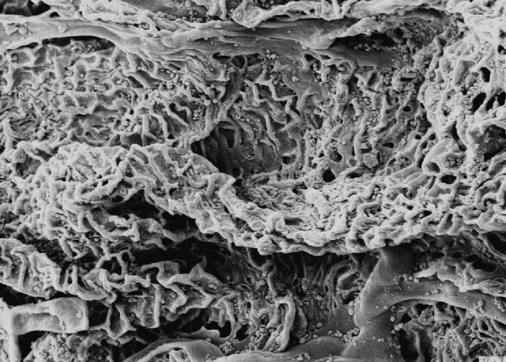 Clusiaceae Paleoclusia chevalieri