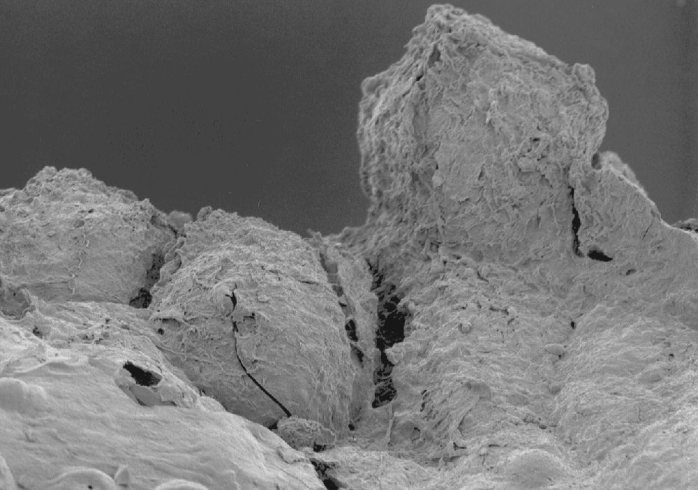 Clusiaceae Paleoclusia chevalieri