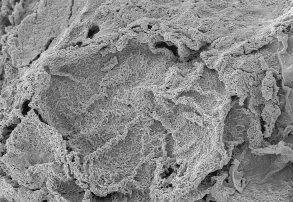 Clusiaceae Paleoclusia chevalieri