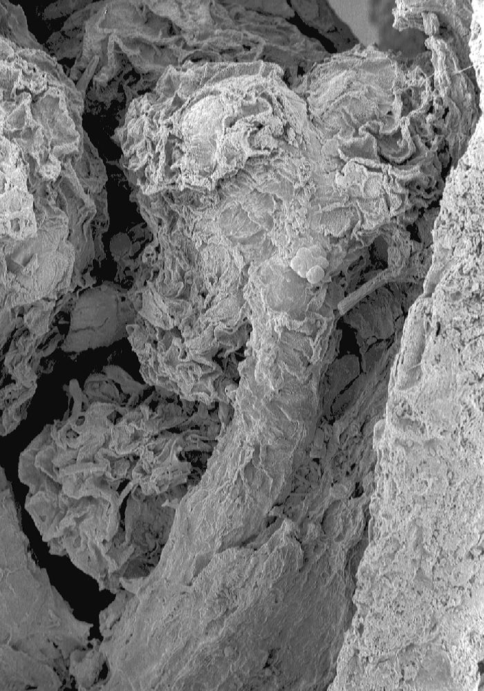 Clusiaceae Paleoclusia chevalieri