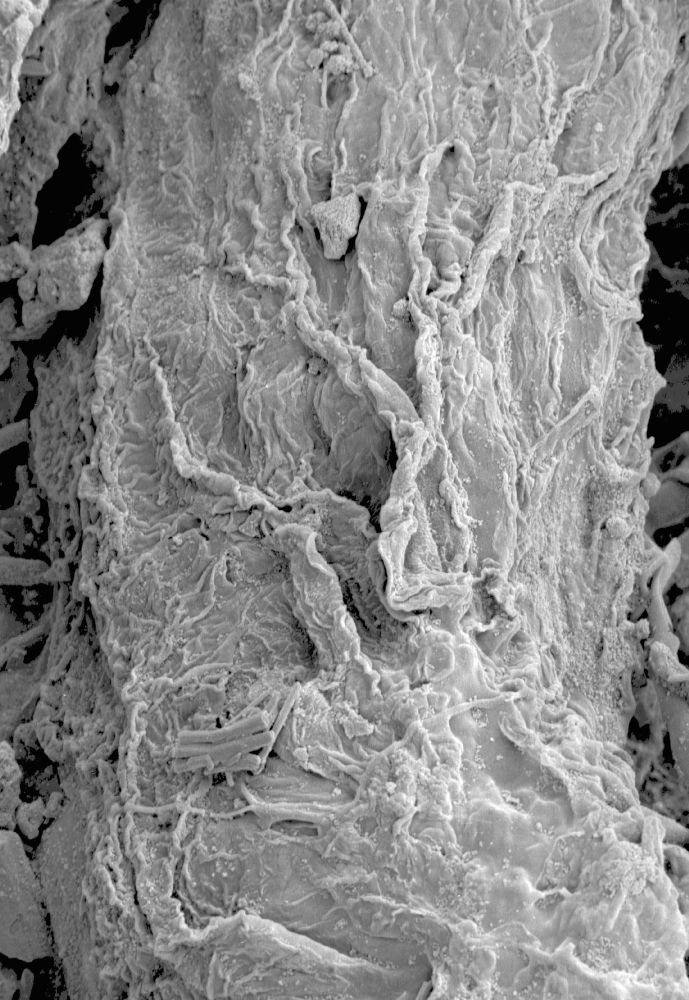 Clusiaceae Paleoclusia chevalieri