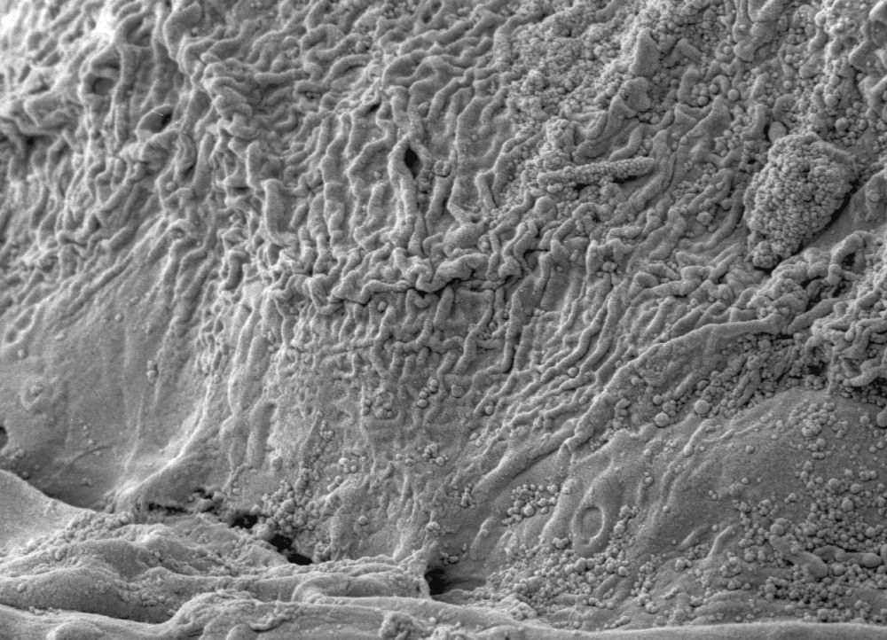 Clusiaceae Paleoclusia chevalieri
