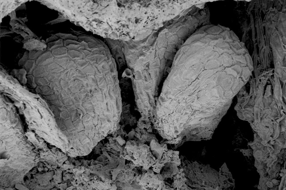 Clusiaceae Paleoclusia chevalieri