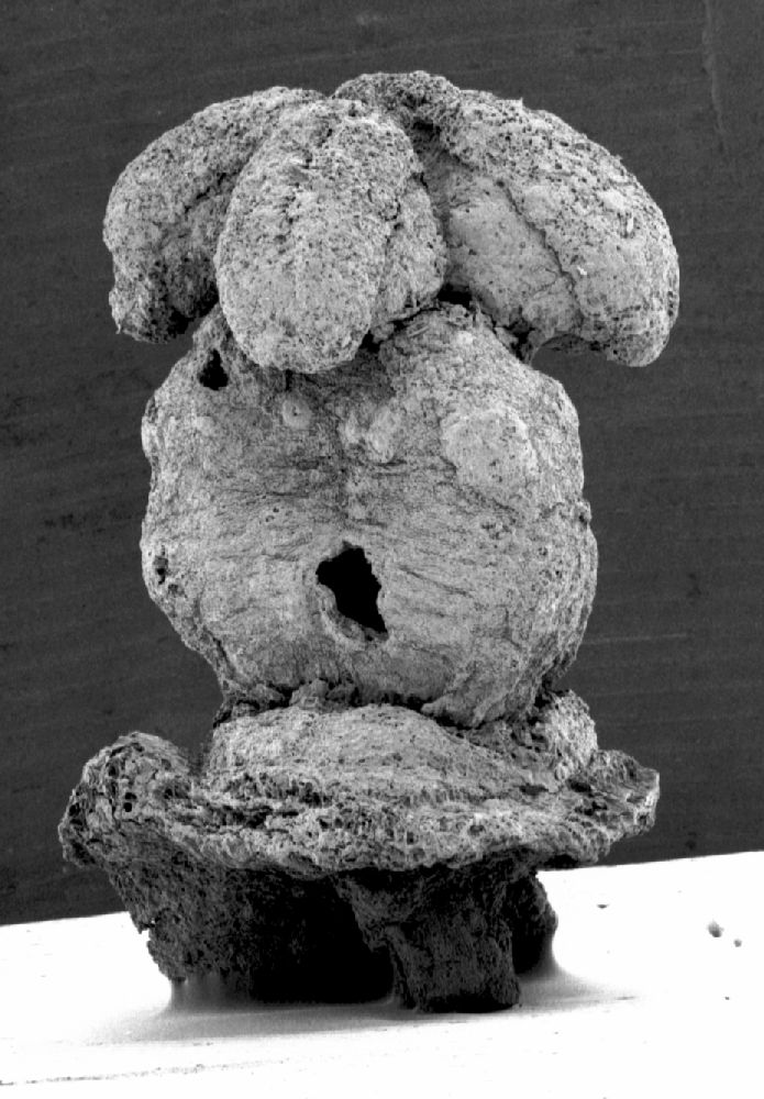 Clusiaceae Paleoclusia chevalieri