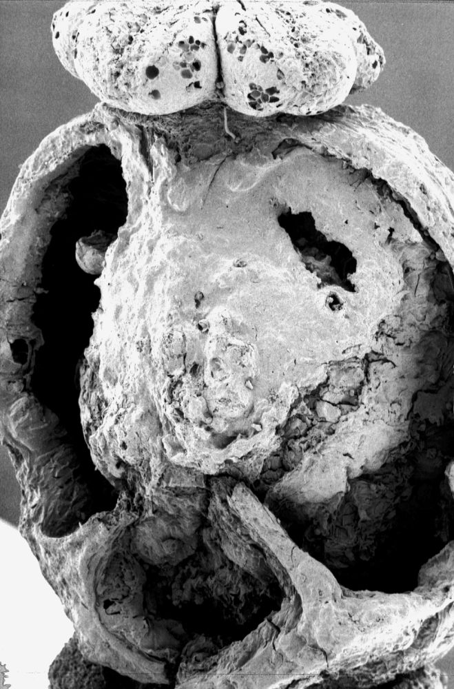 Clusiaceae Paleoclusia chevalieri