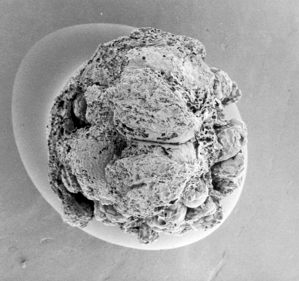Clusiaceae Paleoclusia chevalieri