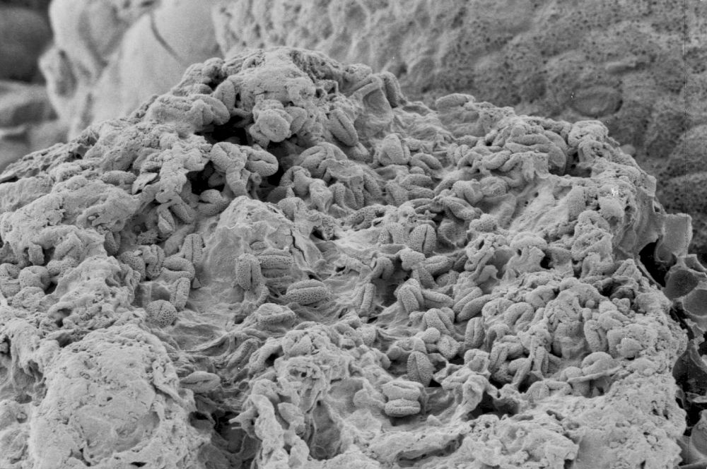 Clusiaceae Paleoclusia chevalieri