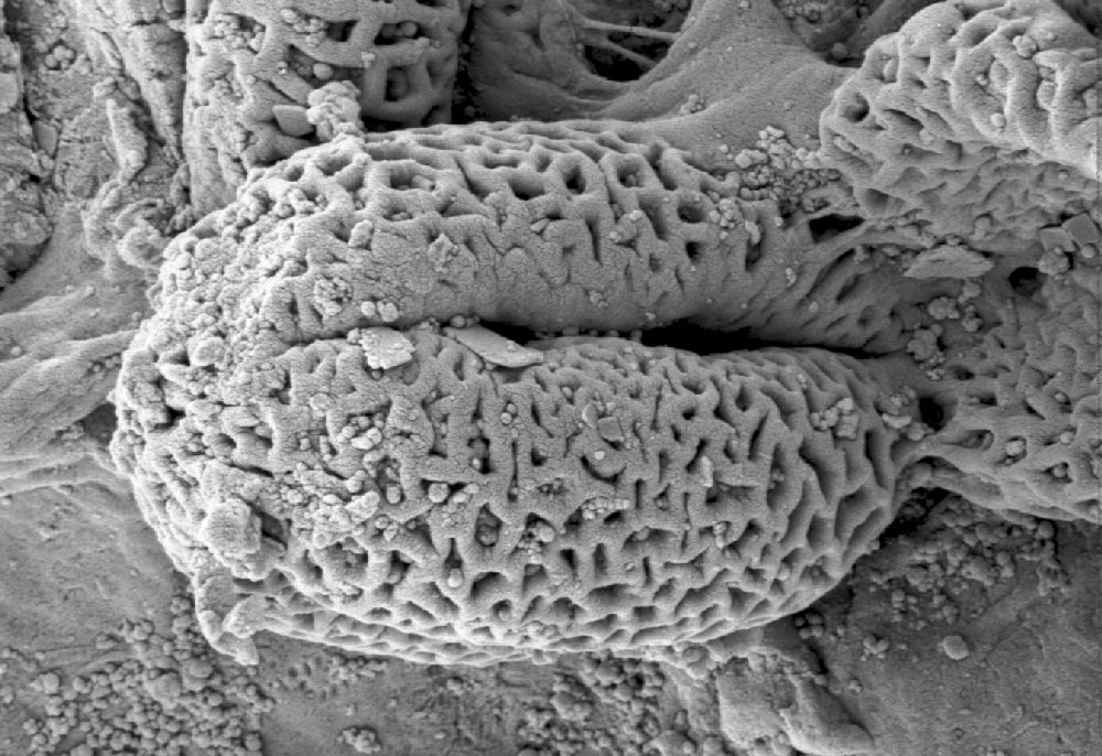 Clusiaceae Paleoclusia chevalieri