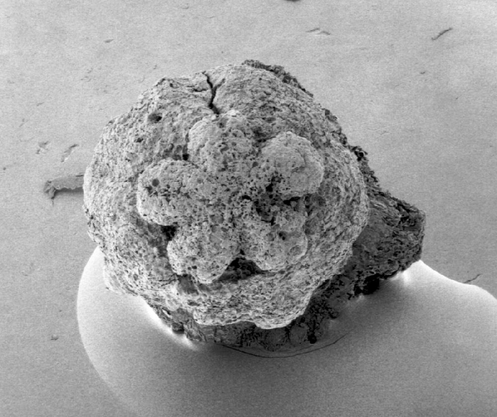 Clusiaceae Paleoclusia chevalieri