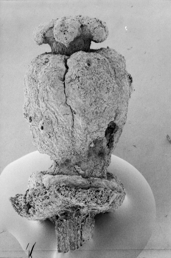 Clusiaceae Paleoclusia chevalieri