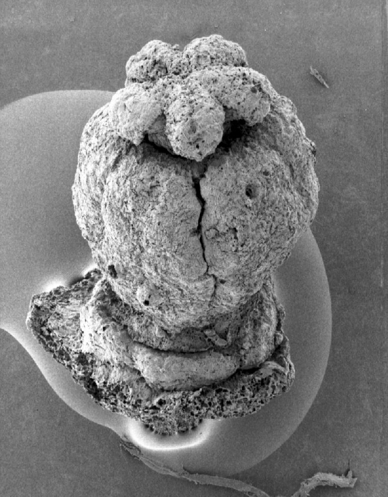 Clusiaceae Paleoclusia chevalieri