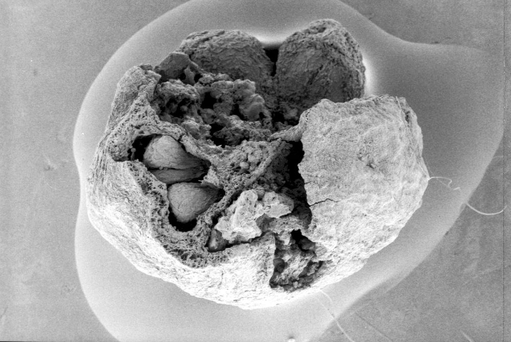 Clusiaceae Paleoclusia chevalieri