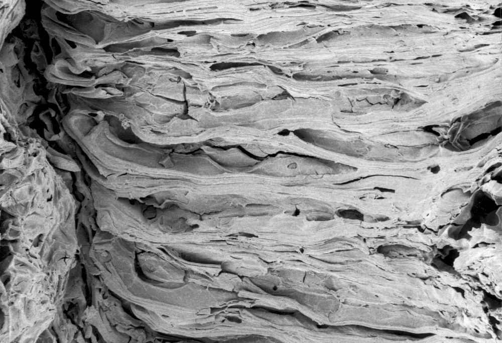 Clusiaceae Paleoclusia chevalieri