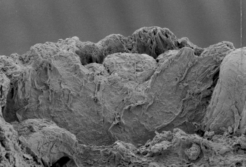 Clusiaceae Paleoclusia chevalieri