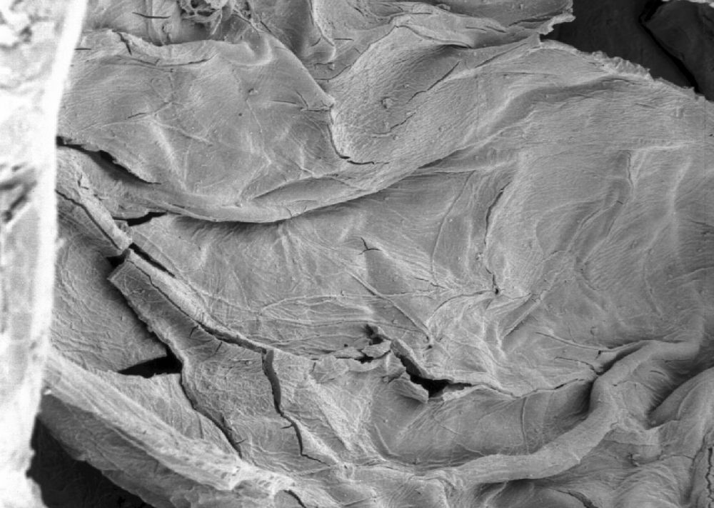 Clusiaceae Paleoclusia chevalieri