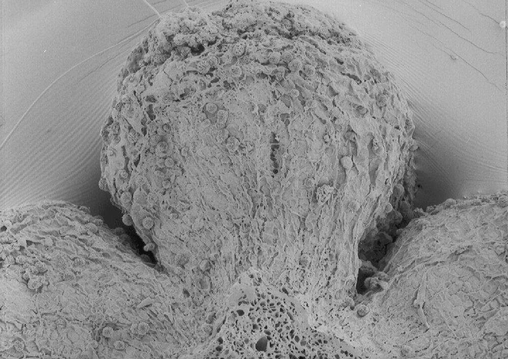 Clusiaceae Paleoclusia chevalieri
