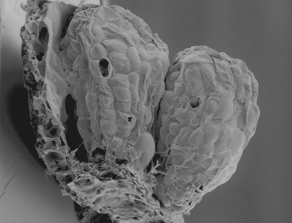 Clusiaceae Paleoclusia chevalieri