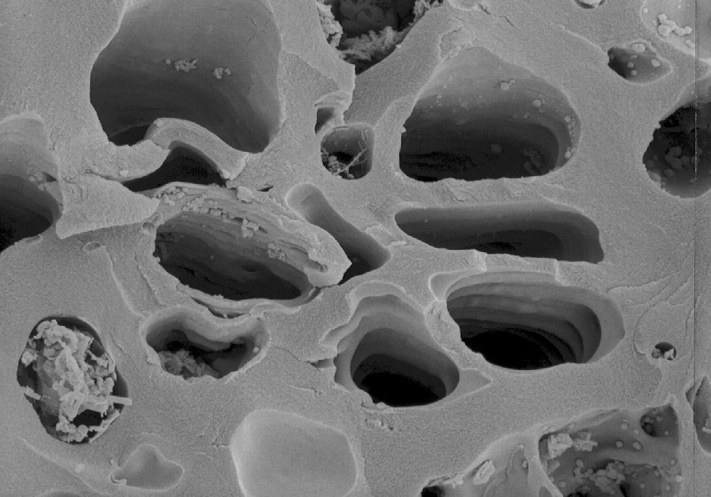 Clusiaceae Paleoclusia chevalieri