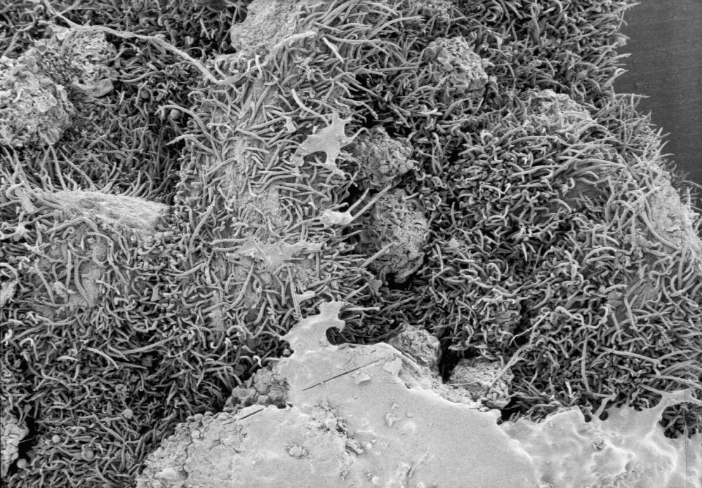 Altingiaceae Altingia 