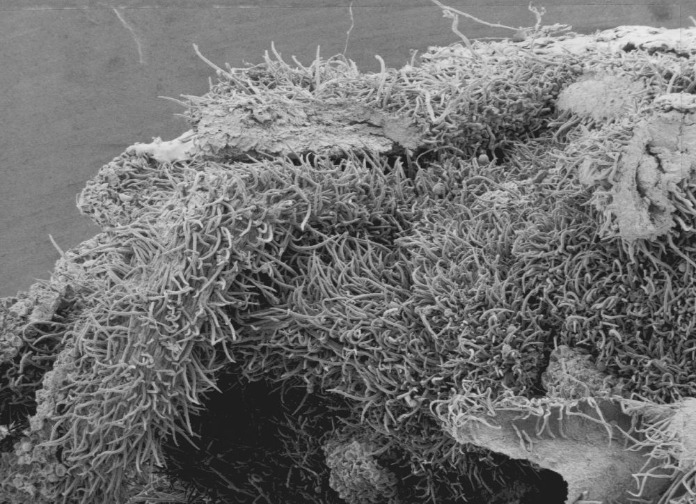 Altingiaceae Altingia 
