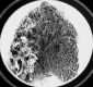 image of Vismia ferruginea