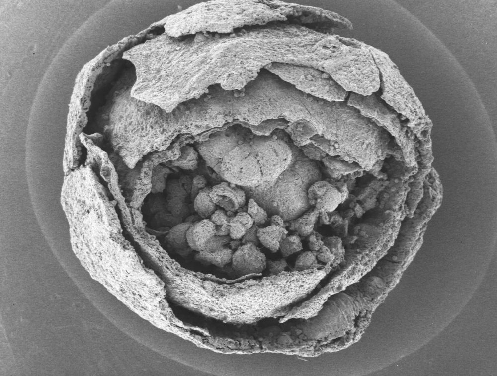 Clusiaceae Paleoclusia chevalieri