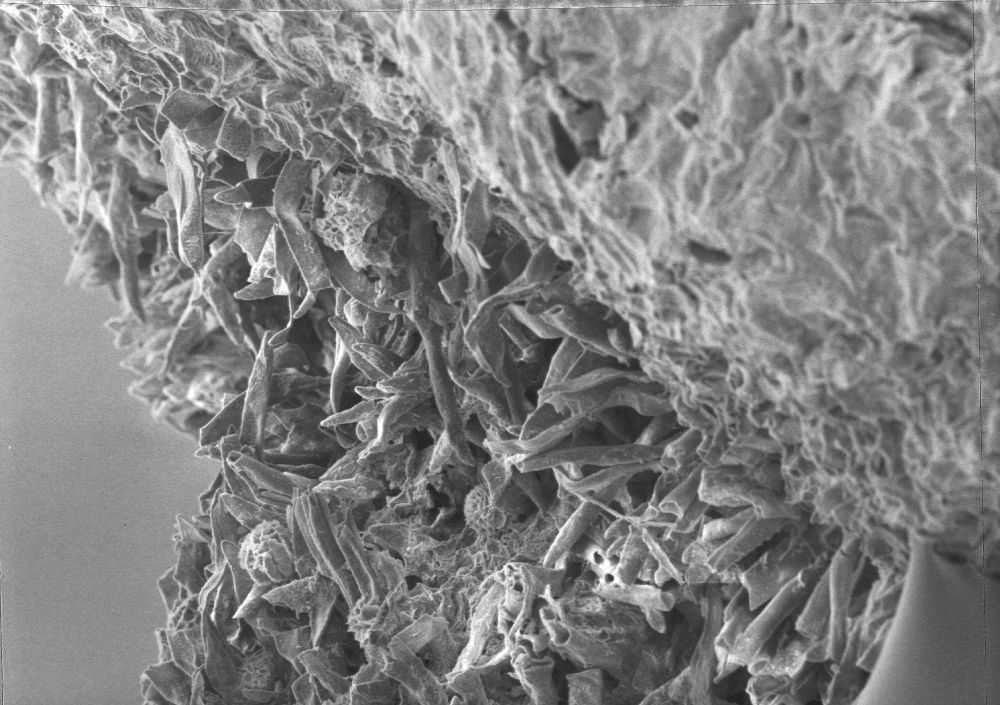 Clusiaceae Paleoclusia chevalieri