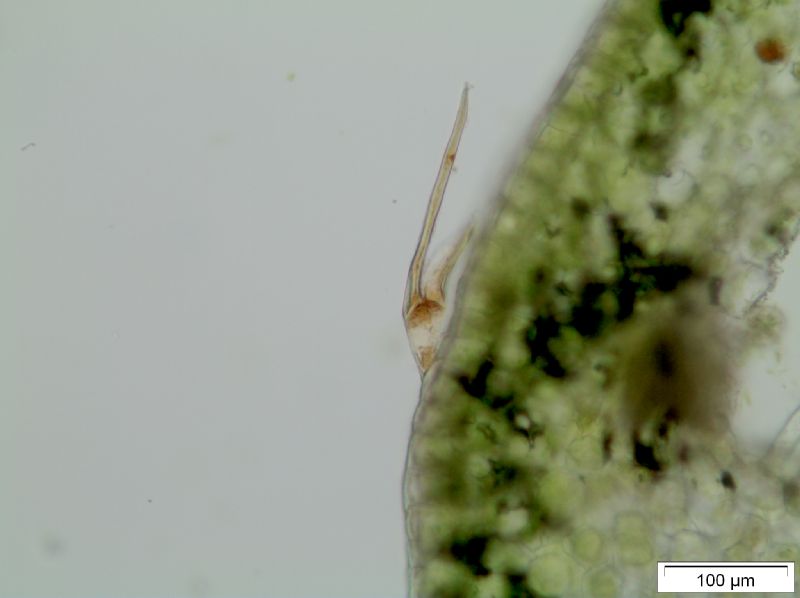 Polypodiaceae Leucotrichum schenckii