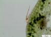 image of Leucotrichum schenckii