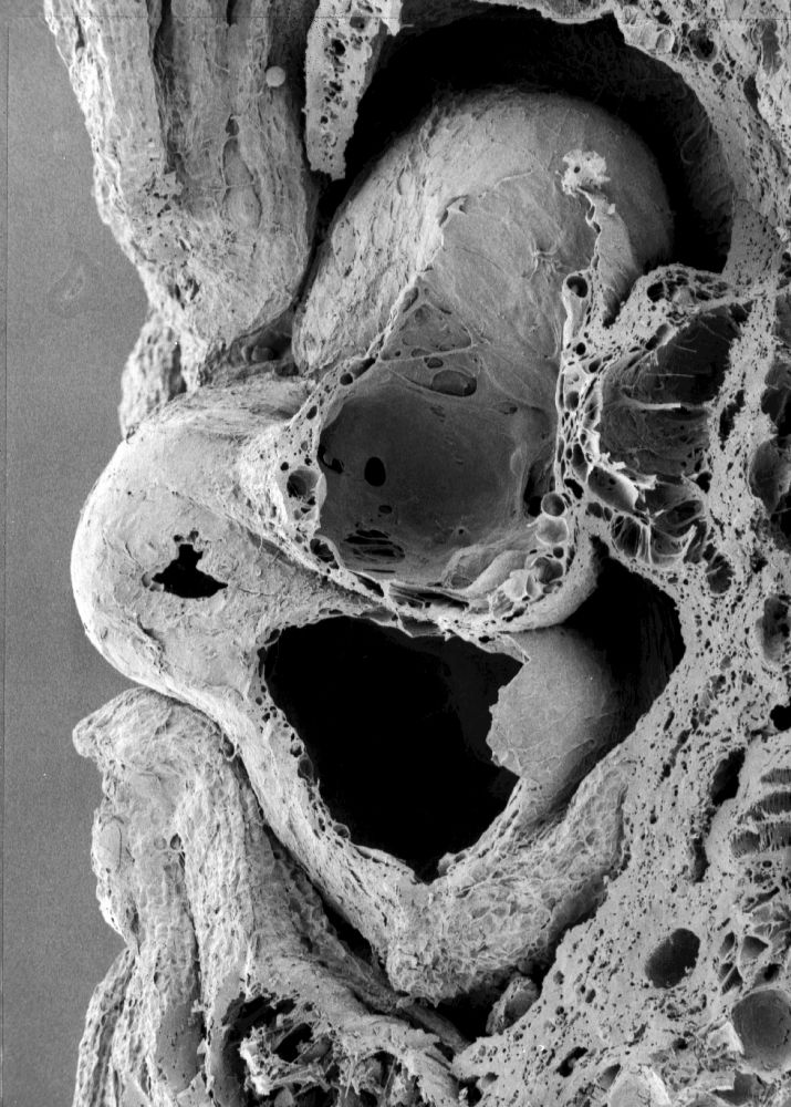 Nymphaeaceae Microvictoria svitkoana