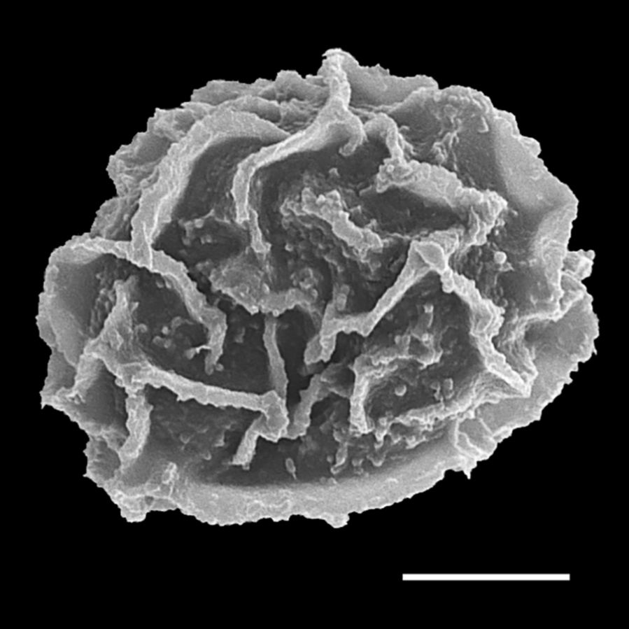 Athyriaceae Anisocampium nipponicum