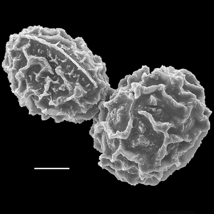 Athyriaceae Anisocampium nipponicum