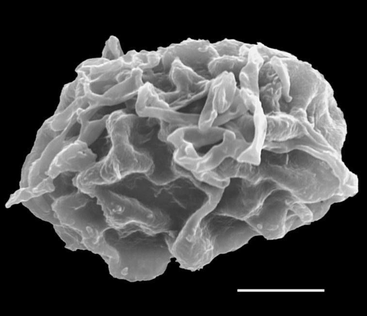 Dryopteridaceae Elaphoglossum edwallii