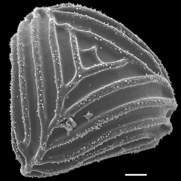 Anemiaceae Anemia familiaris