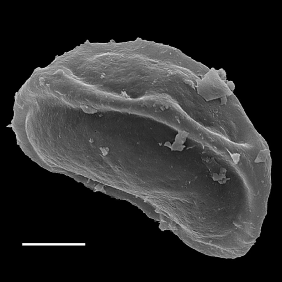 Athyriaceae Diplazium dividissimum
