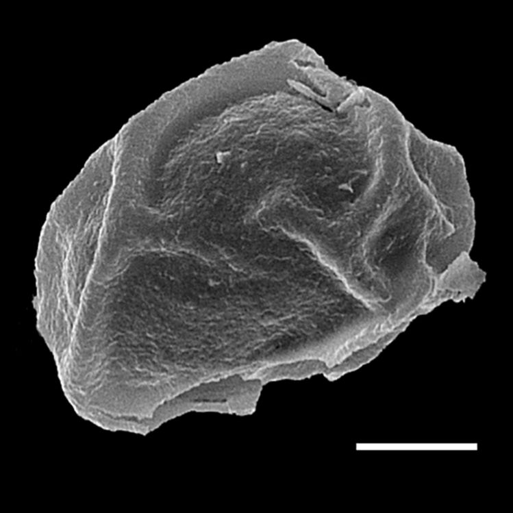 Athyriaceae Athyrium wallichianum