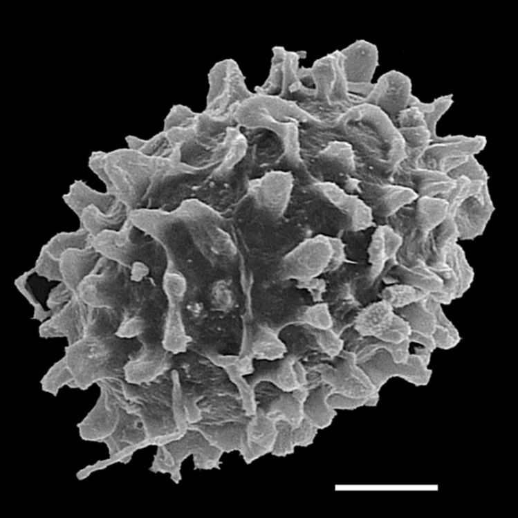 Athyriaceae Deparia petersonii