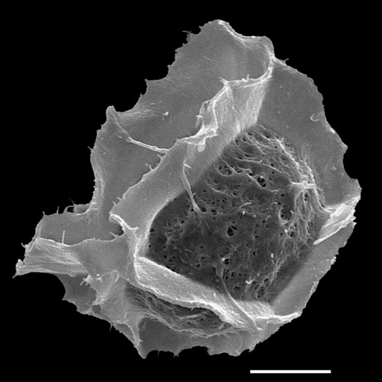 Athyriaceae Diplazium wichurae